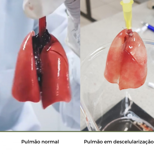 FAPEG Pulmao-normal-4