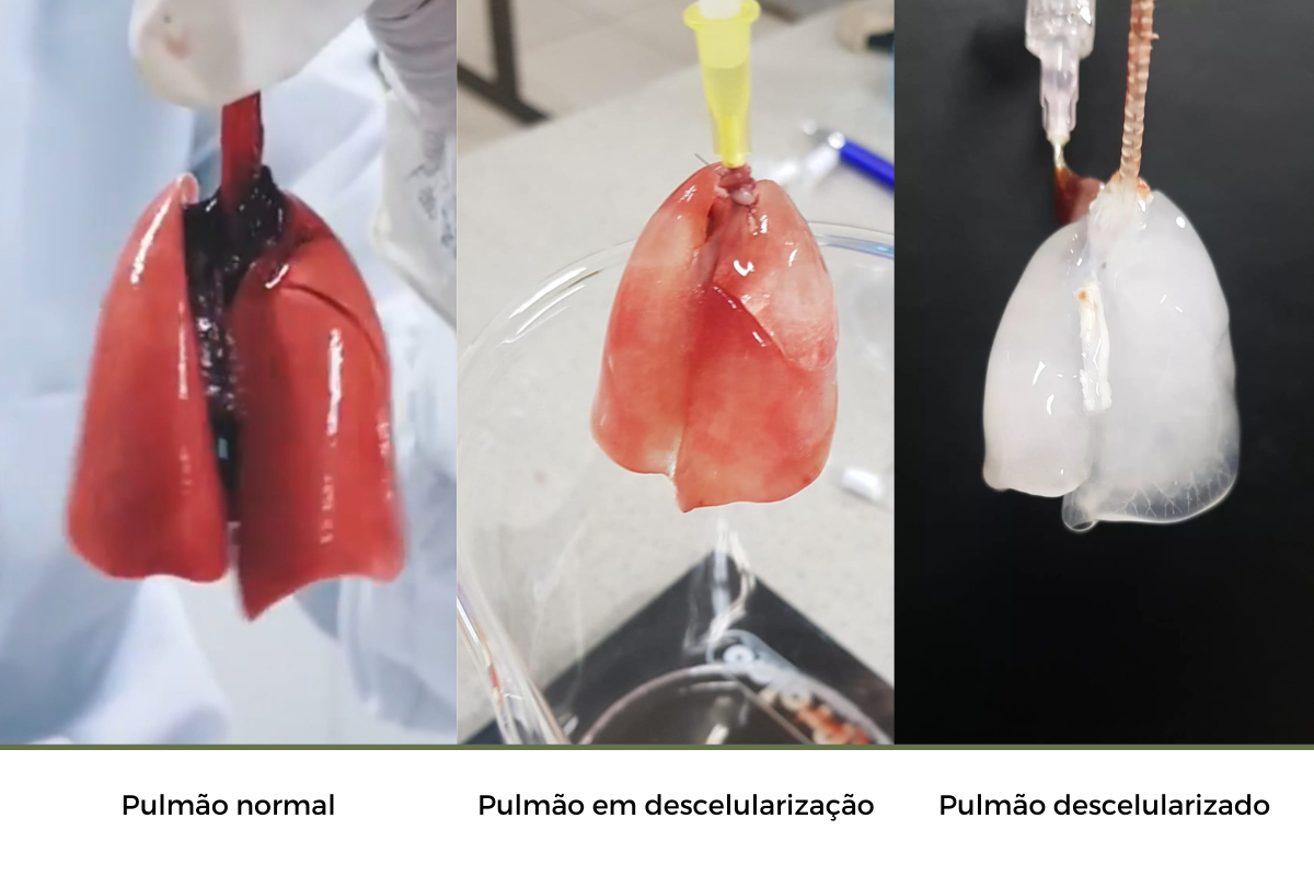 FAPEG Pulmao-normal-4