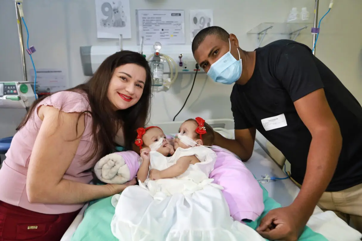 Siamesas Lara e Larissa recebem alta do Hecad após nove meses de internação