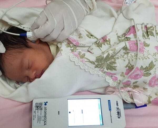 Teste da orelhinha em recém nascido