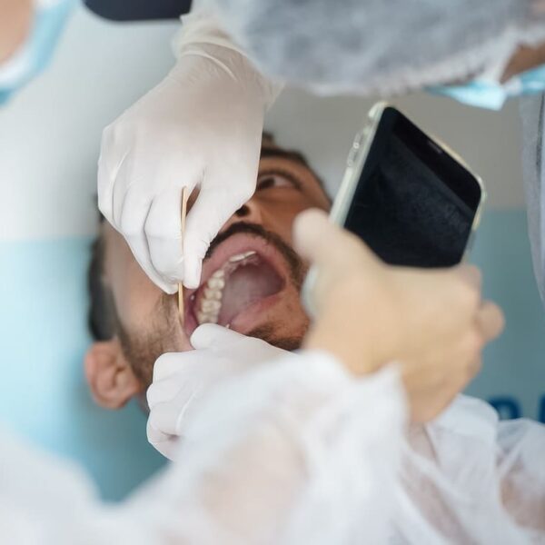 Saúde alerta sobre câncer de boca