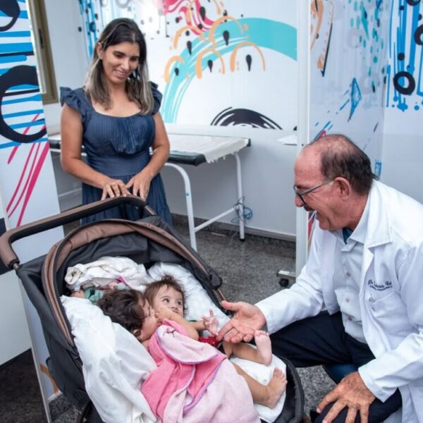 Gêmeas Kiraz e Aruna são internadas no Hecad para cirurgia de separação