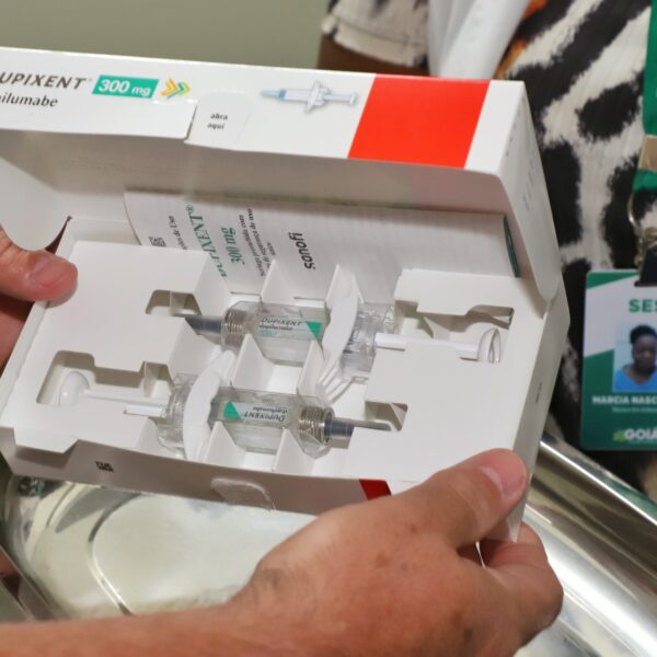 Mão mostra medicação para dermatite atópica