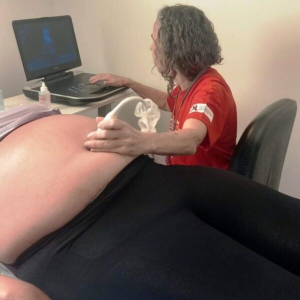 Mutirão de ecocardiogramas fetais do Hemu realiza 78 exames