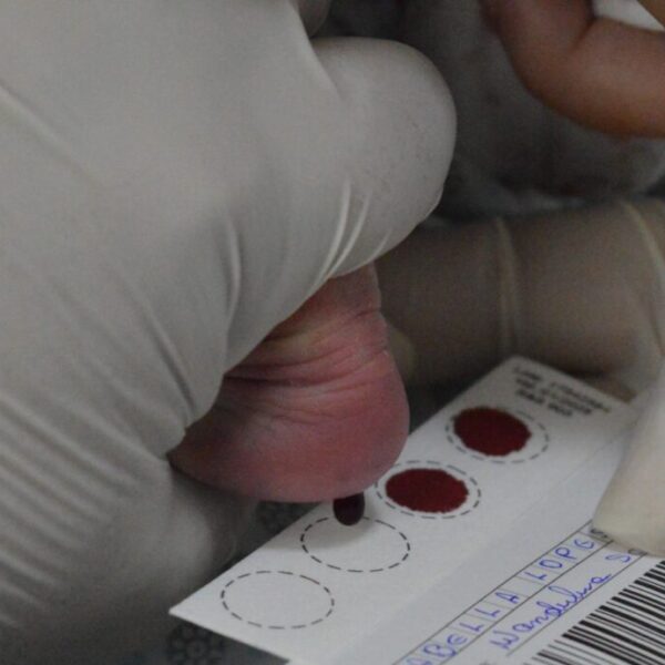 Teste do Pezinho: exame essencial em recém-nascidos