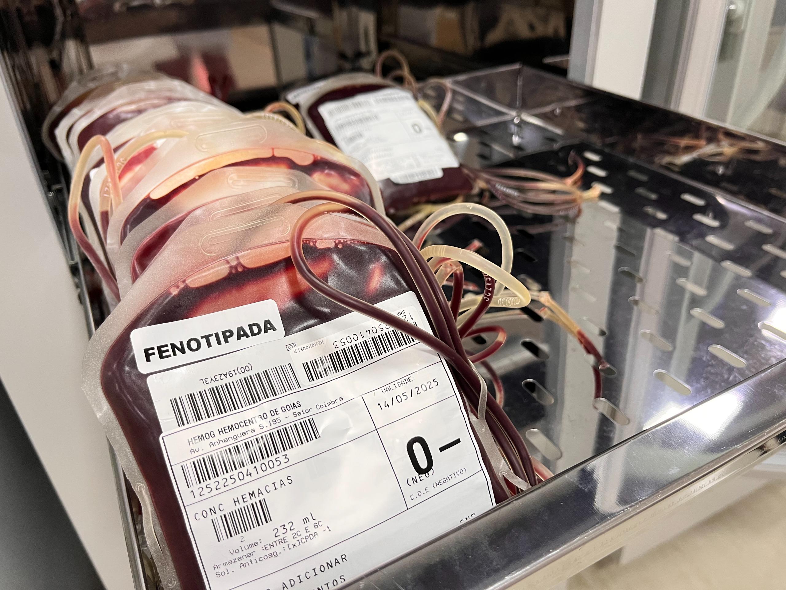 Saúde estadual convoca população a doar sangue O negativo - bolsas de sangue O negativo estocadas