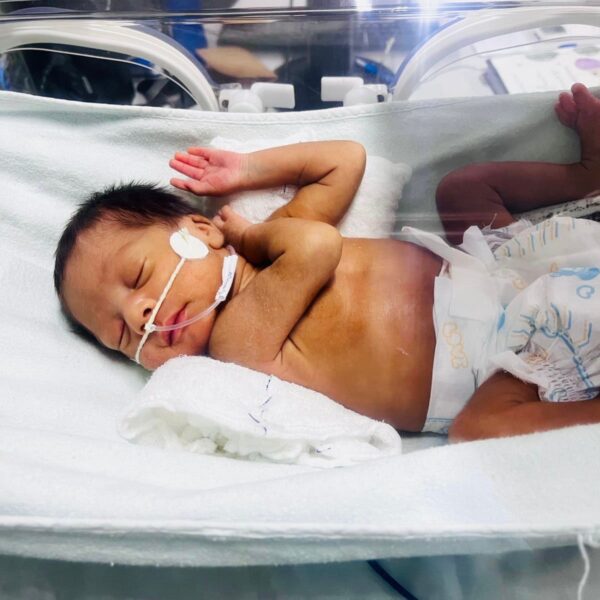 Redeterapia para prematuros no HEMNSL