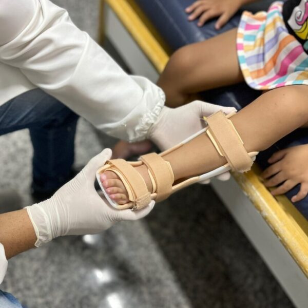 Crer vai entregar 246 dispositivos ortopédicos em Caldas Novas