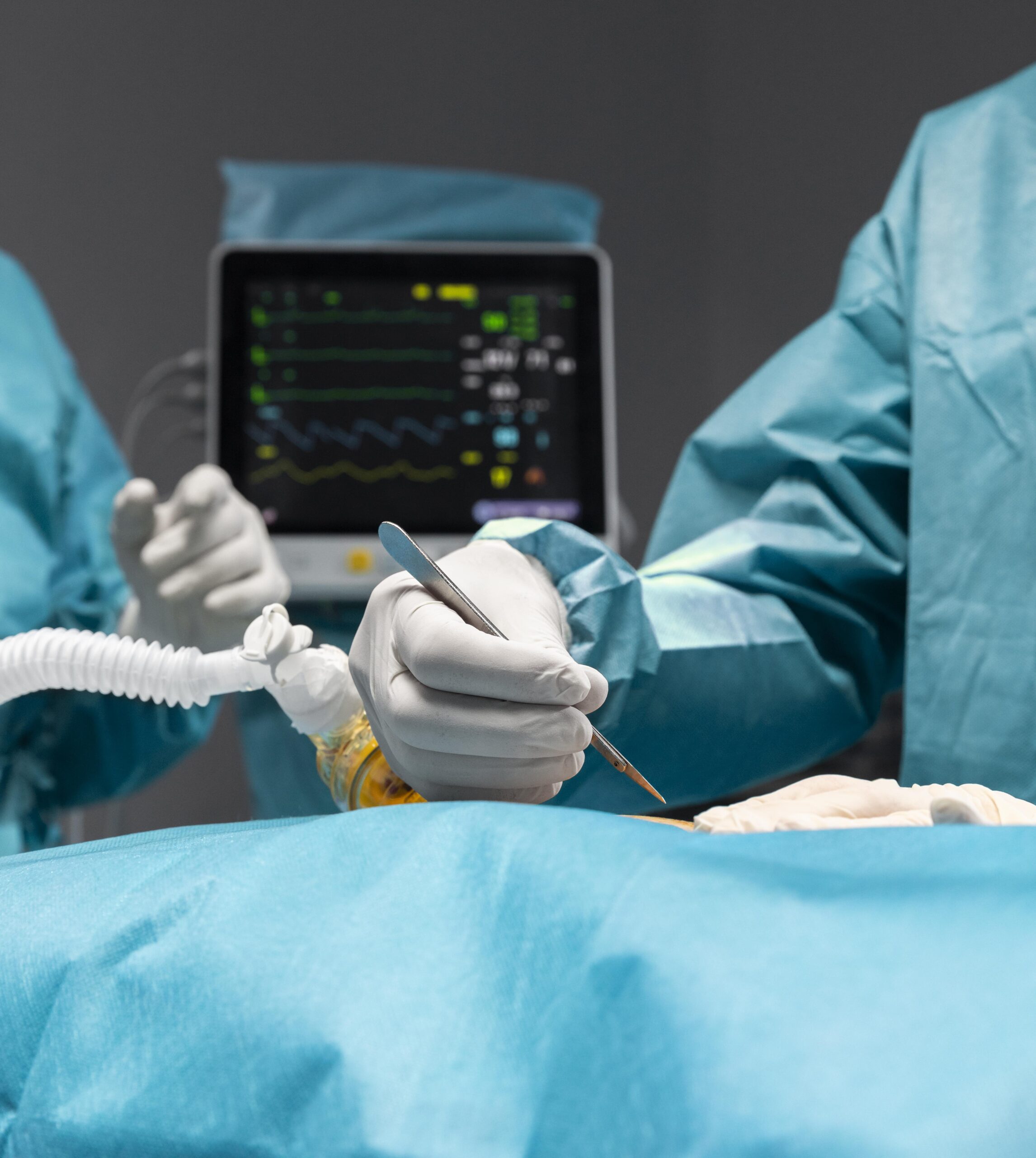 captação de órgãos no Hugol