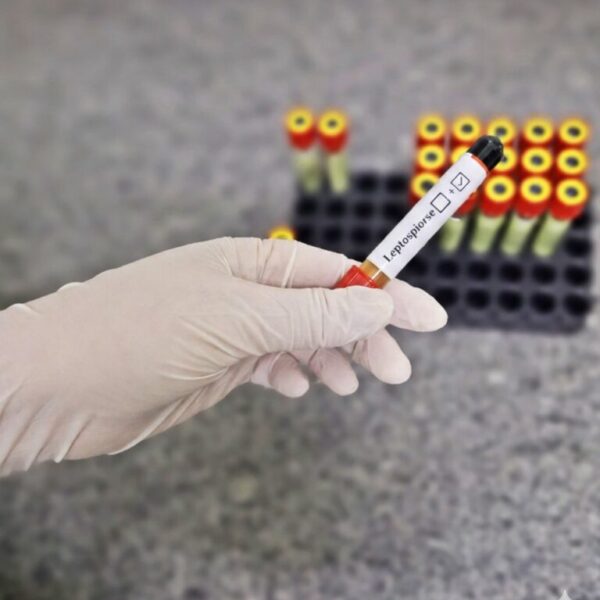 EXAME DE LEPTOSPIROSE